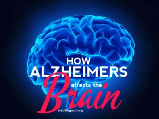 Here's how Alzheimers affects the brain as the condition progresses.