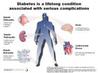Understand The Complications Of Diabetes